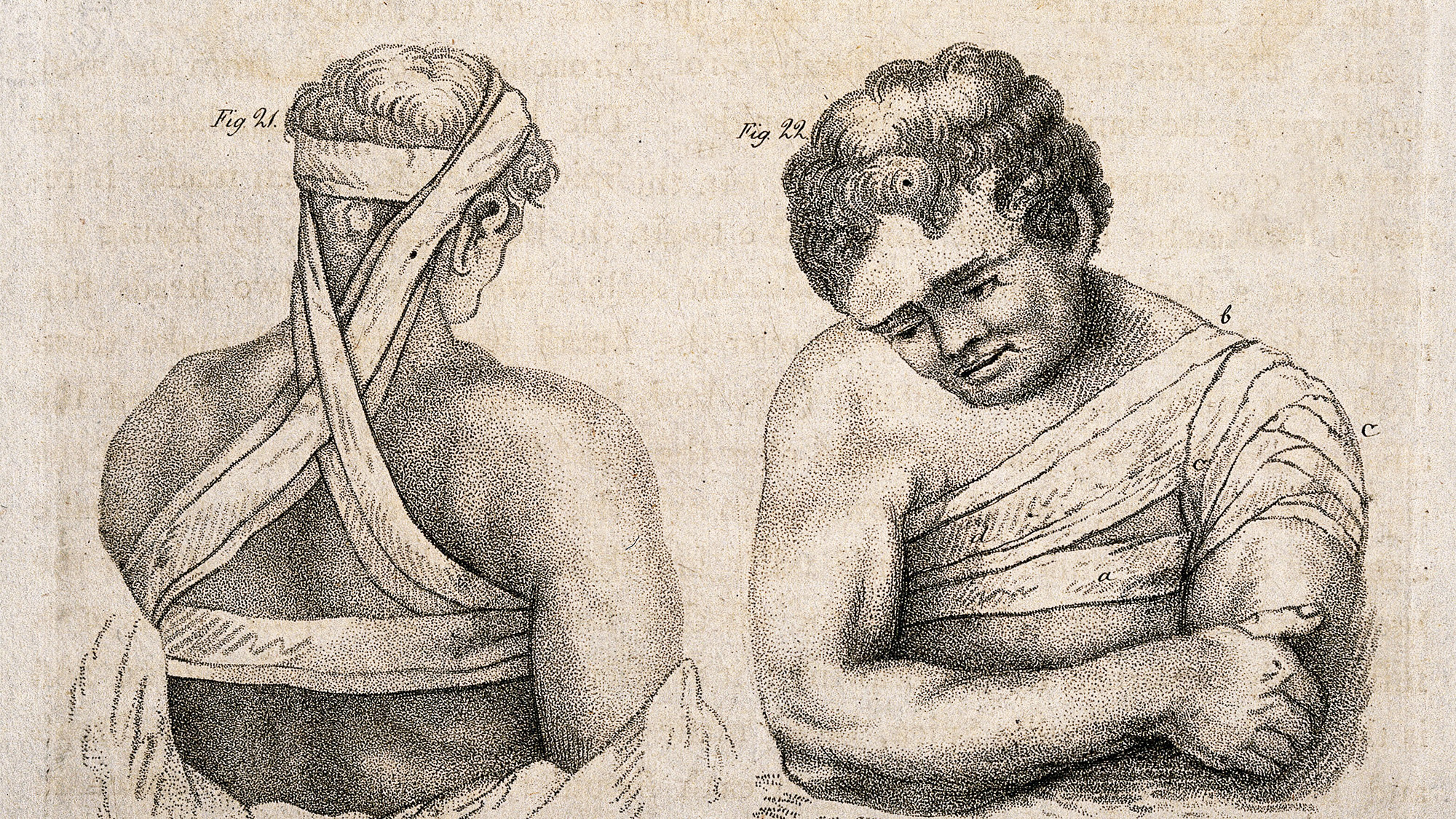 An engraving showing a bandaged figure